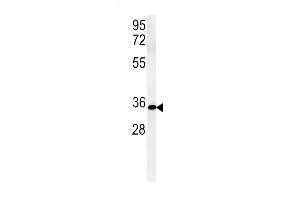 Western blot analysis in mouse Neuro-2a cell line lysates (15ug/lane).