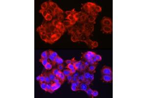Immunofluorescence analysis of HepG2 cells using SSC/SerpinB3 Rabbit pAb (ABIN6131348, ABIN6147587, ABIN6147588 and ABIN6221070) at dilution of 1:100 (40x lens). (SERPINB3 anticorps  (AA 1-230))