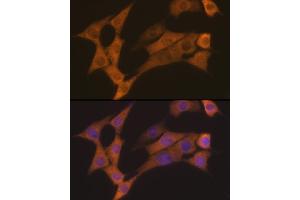 Immunofluorescence analysis of NIH-3T3 cells using Cyclin B2 Rabbit mAb (ABIN7266557) at dilution of 1:100 (40x lens). (Cyclin B2 anticorps)