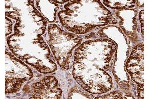 ABIN6278956 at 1/100 staining Human kidney tissue by IHC-P. (WNT7B anticorps  (C-Term))