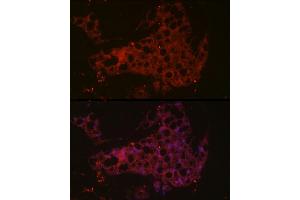 Immunofluorescence analysis of mouse brown adipose cells using UCP1 Rabbit pAb (ABIN6128899, ABIN6149883, ABIN6149885 and ABIN6221561) at dilution of 1:50 (40x lens).