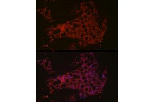 Immunofluorescence analysis of mouse brown adipose cells using UCP1 Rabbit pAb (ABIN6128899, ABIN6149883, ABIN6149885 and ABIN6221561) at dilution of 1:50 (40x lens). (UCP1 anticorps  (AA 1-307))