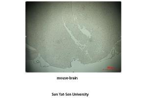Immunohistochemistry (IHC) analysis: Please contact us for more details. (TH anticorps  (Tyr161))