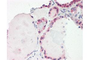 Anti-LEREPO4 / ZC3H15 antibody IHC of human thyroid.