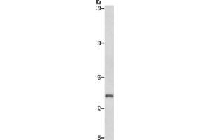 Western Blotting (WB) image for anti-ATP-Binding Cassette, Sub-Family B (MDR/TAP), Member 6 (ABCB6) antibody (ABIN2428945) (ABCB6 anticorps)