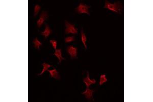 ABIN6275219 staining Hela by IF/ICC. (MASP2 anticorps  (Internal Region))
