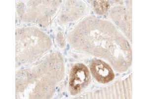 ABIN6266916 at 1/100 staining human kidney tissue sections by IHC-P. (TNFAIP2 anticorps)