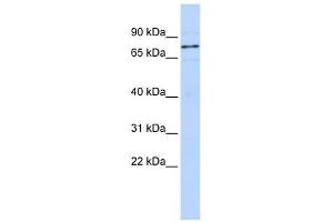 WBP11 antibody used at 1 ug/ml to detect target protein.