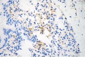 Immunohistochemistry was performed on paraffin-embedded mouse lung using caveolin 1 antibody (ABIN7797944), 1:200). (Recombinant Caveolin-1 anticorps)