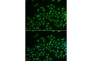 Immunofluorescence analysis of U2OS cell using MPP2 antibody. (MPP2 anticorps)