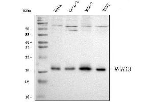 Western blot analysis of RAB13 using anti-RAB13 antibody (ABIN3043916). (RAB13 anticorps  (C-Term))
