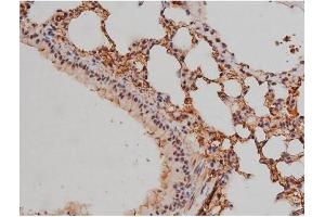 ABIN6267333 at 1/200 staining Mouse lung tissue sections by IHC-P.