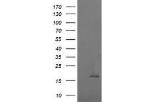 Image no. 1 for anti-Cancer/testis Antigen 1B (CTAG1B) antibody (ABIN1499901) (CTAG1B anticorps)