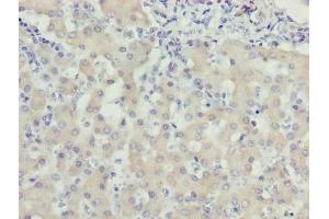 Immunohistochemistry of paraffin-embedded human liver tissue using ABIN7175806 at dilution of 1:100 (WDR91 anticorps  (AA 1-747))