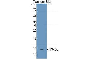 WB of Protein Standard: different control antibodies against Highly purified E. (IL17F Kit ELISA)
