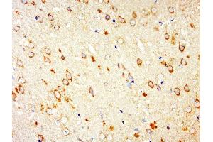 Paraformaldehyde-fixed, paraffin embedded rat brain, Antigen retrieval by boiling in sodium citrate buffer (pH6.