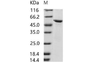 HIV-2 gp36 protein (His tag,MBP tag)