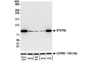 Western Blotting (WB) image for anti-Signal Transducer and Activator of Transcription 5B (STAT5B) (AA 737-787) antibody (ABIN7455110) (Recombinant STAT5B anticorps  (AA 737-787))