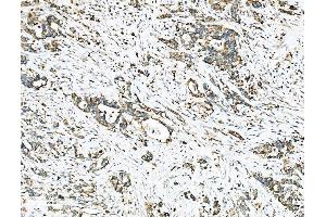 IHC analysis of Ezrin/EZR using anti-Ezrin/EZR antibody (ABIN7603214). (Ezrin anticorps  (N-Term))