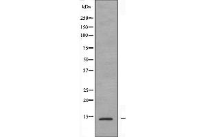 anti-Prefoldin Subunit 1 (PFDN1) (Internal Region) antibody