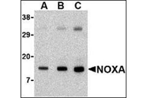 Western blot analysis of Noxa in human stomach tissue lysate with this product at (A) 0.