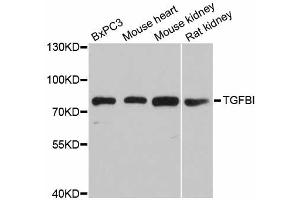 Western blot analysis of extracts of various cell lines, using TGFBI antibody (ABIN5971386) at 1/1000 dilution. (TGFBI anticorps)