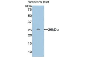 Western Blotting (WB) image for anti-L1 Cell Adhesion Molecule (L1CAM) (AA 218-423) antibody (ABIN1173993) (L1CAM anticorps  (AA 218-423))