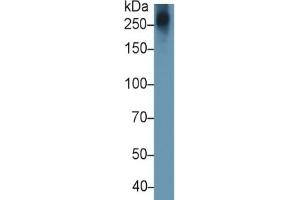 Mouse Capture antibody from the kit in WB with Positive Control:  Human Lymphocyte lysate.