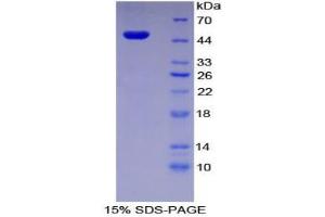 SDS-PAGE analysis of Human PAI1 Protein. (PAI1 Protéine)