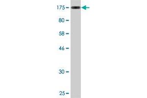 Western Blot detection against Immunogen (118.