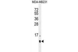 Western Blotting (WB) image for anti-Host Cell Factor C1 Regulator 1 (XPO1 Dependent) (HCFC1R1) antibody (ABIN2996292)