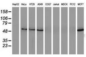 Image no. 2 for anti-Sequestosome 1 (SQSTM1) antibody (ABIN1499991) (SQSTM1 anticorps)