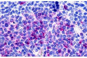 Image no. 1 for anti-G Protein-Coupled Receptor 160 (GPR160) (Extracellular Domain) antibody (ABIN1048744)