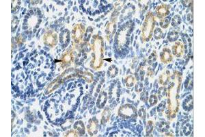 Image no. 1 for anti-Interferon Regulatory Factor 8 (IRF8) (AA 35-84) antibody (ABIN202494)