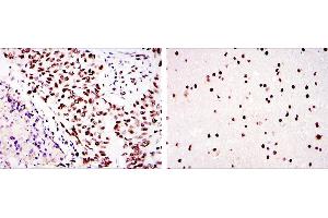 Immunohistochemical analysis of paraffin-embedded lung cancer (left) and brain tissues (right) using PRKDC mouse mAb with DAB staining.