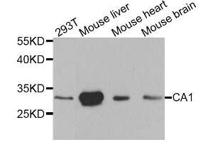 Western blot analysis of extracts of various cell lines, using CA1 antibody.