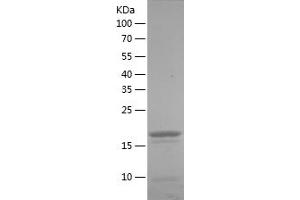 Western Blotting (WB) image for Toll-Like Receptor Adaptor Molecule 1 (TICAM1) (AA 29-204) protein (His tag) (ABIN7125415)