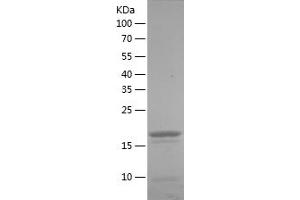 TICAM1 Protein (AA 29-204) (His tag)