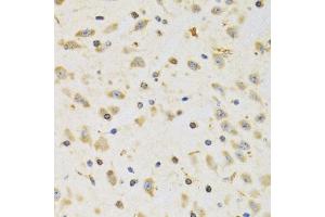 Immunohistochemistry of paraffin-embedded rat brain using RPS12 antibody (ABIN1980257) at dilution of 1:100 (40x lens). (RPS12 anticorps)