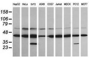 Image no. 1 for anti-Mitogen-Activated Protein Kinase Kinase 1 (MAP2K1) antibody (ABIN1499395) (MEK1 anticorps)