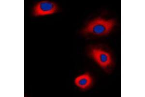 Immunofluorescent analysis of VASP staining in HepG2 cells.