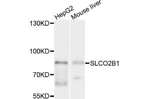 Western blot analysis of extracts of various cell lines, using SLCO2B1 antibody (ABIN6003779) at 1/1000 dilution. (SLCO2B1 anticorps)