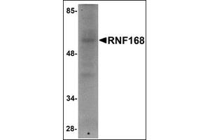 Western blot analysis of RNF168 in human brain tissue lysate with this product at 1 μg/ml. (RNF168 anticorps  (C-Term))