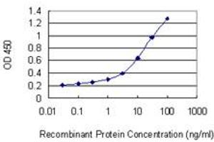 Detection limit for recombinant GST tagged SLC39A13 is 0.