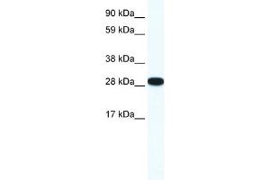 WB Suggested Anti-ZFP36L1 Antibody Titration: 0. (ZFP36L1 anticorps  (N-Term))