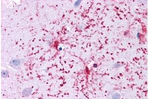 Human Brain, Cortex: Formalin-Fixed, Paraffin-Embedded (FFPE)