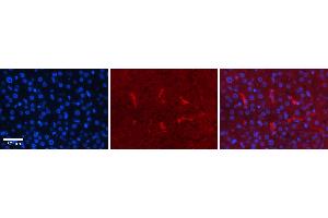 Rabbit Anti-CDK2 Antibody Catalog Number: ARP30331_P050 Formalin Fixed Paraffin Embedded Tissue: Human Liver Tissue Observed Staining: Cytoplasm in Kupffer cells Primary Antibody Concentration: 1:100 Other Working Concentrations: N/A Secondary Antibody: Donkey anti-Rabbit-Cy3 Secondary Antibody Concentration: 1:200 Magnification: 20X Exposure Time: 0.