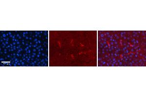 Rabbit Anti-CDK2 Antibody Catalog Number: ARP30331_P050 Formalin Fixed Paraffin Embedded Tissue: Human Liver Tissue Observed Staining: Cytoplasm in Kupffer cells Primary Antibody Concentration: 1:100 Other Working Concentrations: N/A Secondary Antibody: Donkey anti-Rabbit-Cy3 Secondary Antibody Concentration: 1:200 Magnification: 20X Exposure Time: 0. (CDK2 anticorps  (Middle Region))