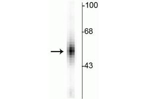 Western blot of human dorsal Raphe nucleus showing specific immunolabeling of the ~55 kDa tryptophan hydroxylase protein. (Tryptophan Hydroxylase 1 anticorps)