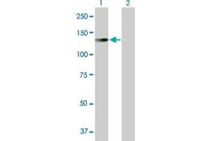 Western Blot analysis of LONP1 expression in transfected 293T cell line by LONP1 MaxPab polyclonal antibody. (LONP1 anticorps  (AA 1-959))